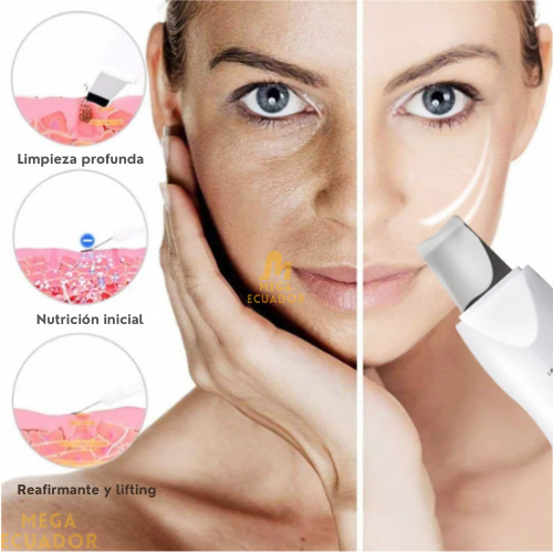 GlowGiver™ Limpiador Ultrasonico Premium